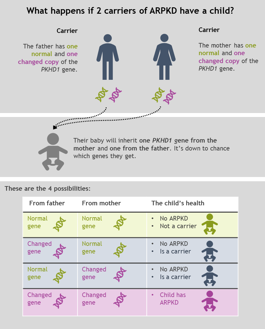 Diagram showing the 4 possible outcomes if 2 carriers of ARPKD have a child, as explained in the text above