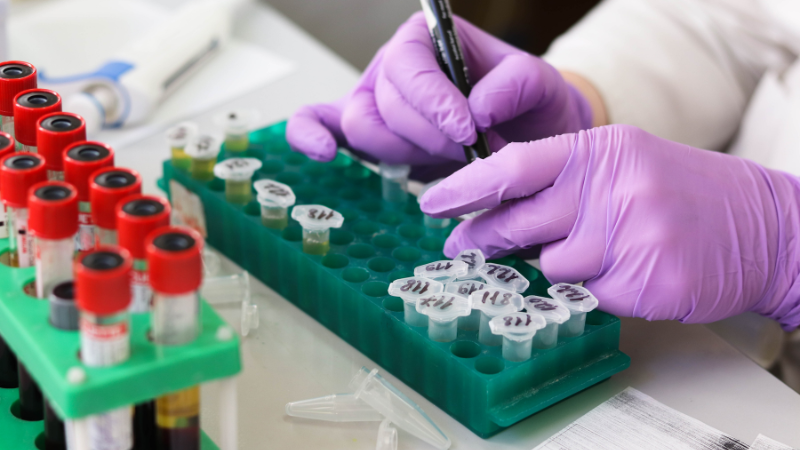 Professor Patricia Wilson and the PKD BioResource Bank