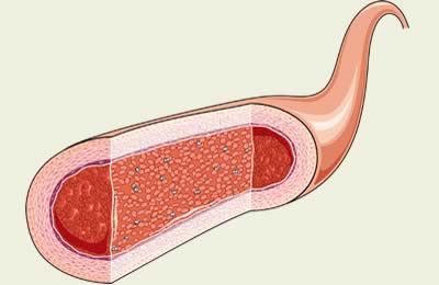 Blood vessel carrying blood