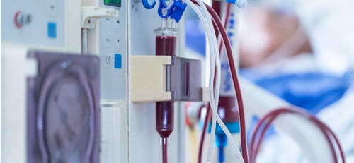 Close-up of a dialysis machine