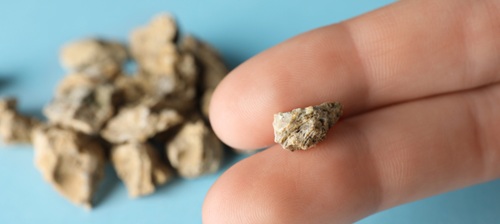 Two fingers holding a kidney stone with a pile of kidney stones in the background