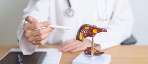 Model of polycystic liver on desk with scientist in white coat pointing pen at it