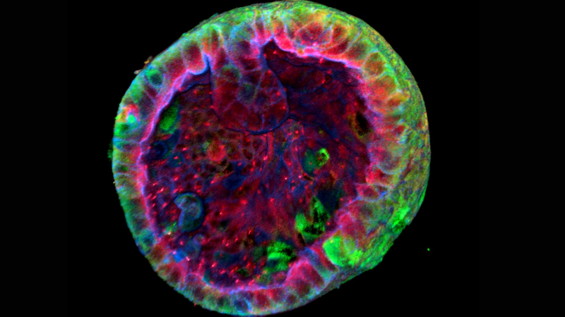 Lab grown kidneys could lead to new treatments that slow disease progression