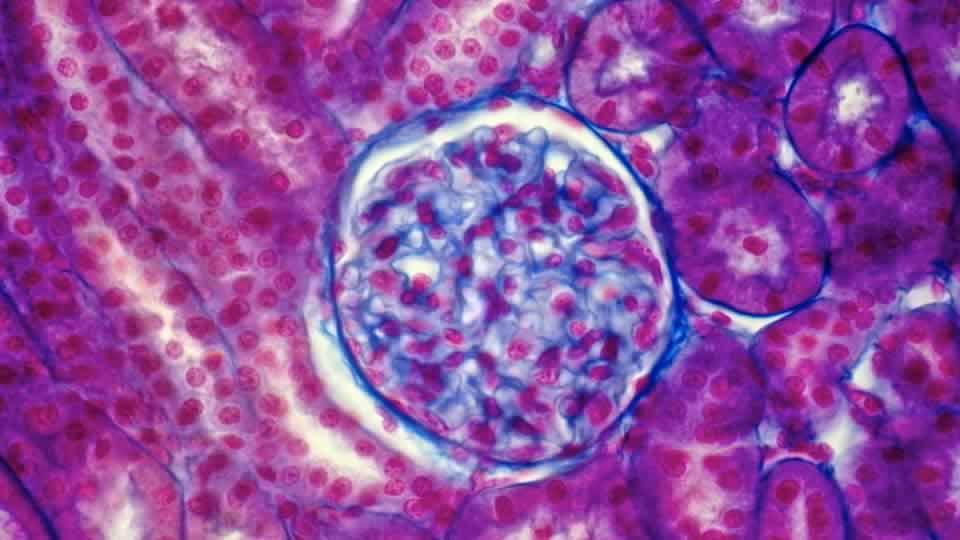 Grant to promote PKD treatment research