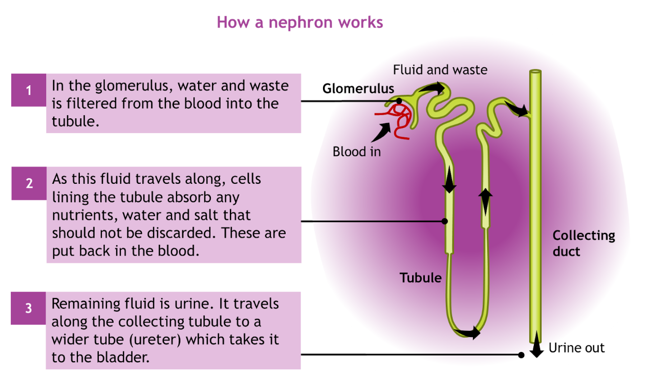 A picture of a nephron. The nephron is a thin, long, winding tube. At the top of the nephron sits a ball of blood vessels called the glomerulus. Water and waste pass through these vessels into the tubule. Waste fluid (urine) flows via a collecting tube to the bladder.