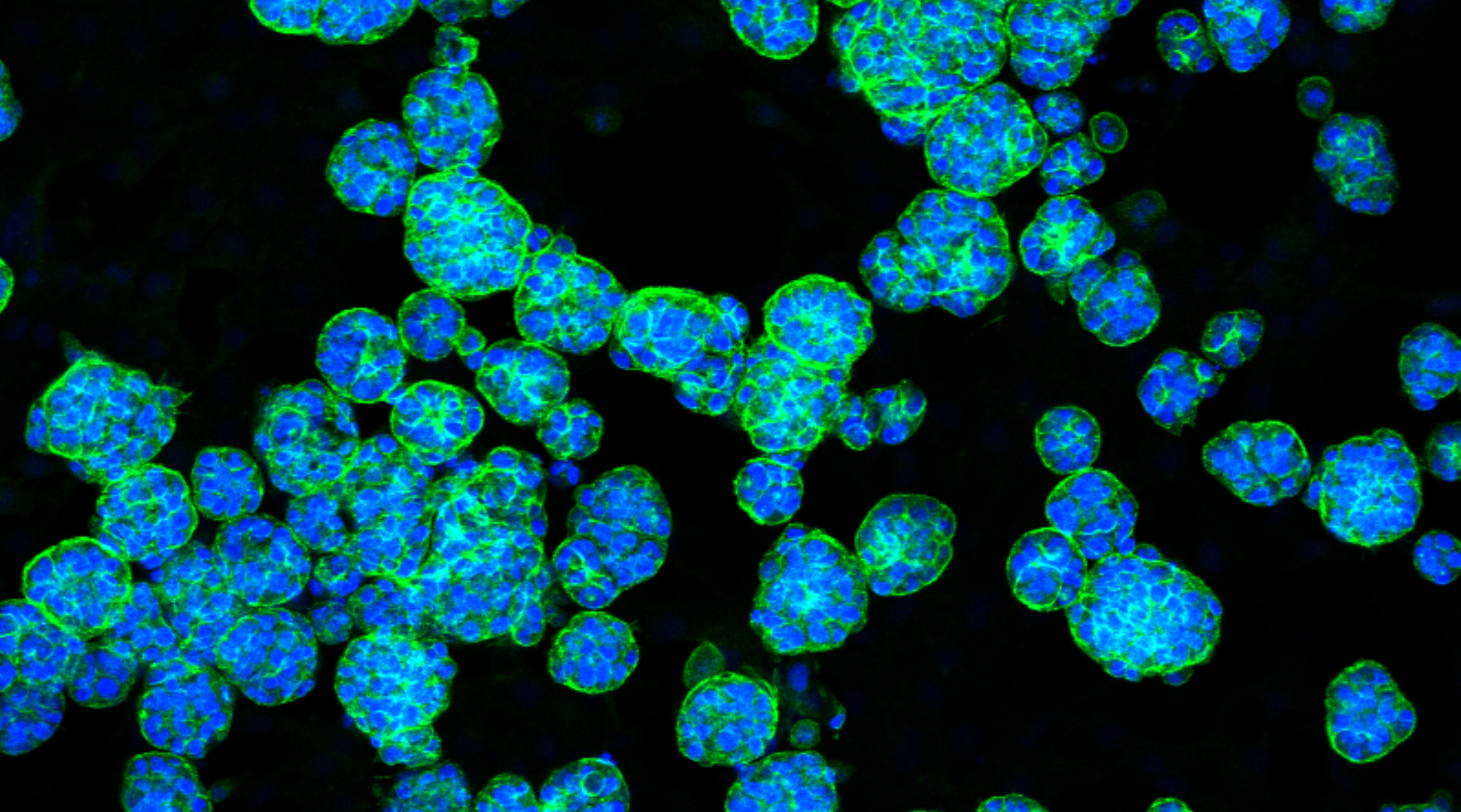 Could gene therapy help children with ARPKD in the future?