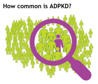 Illustration of a crowd of people, zooming in on a person with ADPKD.