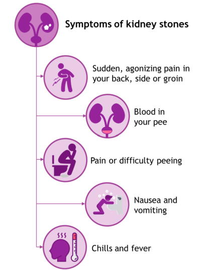 Picture showing the symptoms of kidney stones (as listed in the text above).