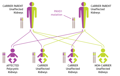 A diagram showing how ARPKD genes can be inherited, as we explain in the text above.