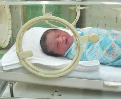 Picture of a newborn baby in an incubator.
