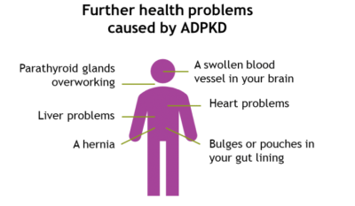 Diagram showing further health problems caused by ADPKD, as listed below.